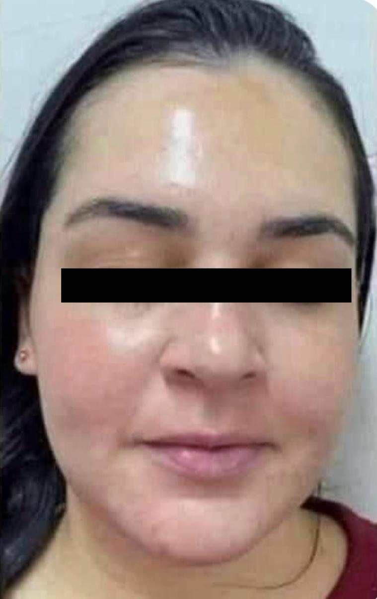 Danielle
depois